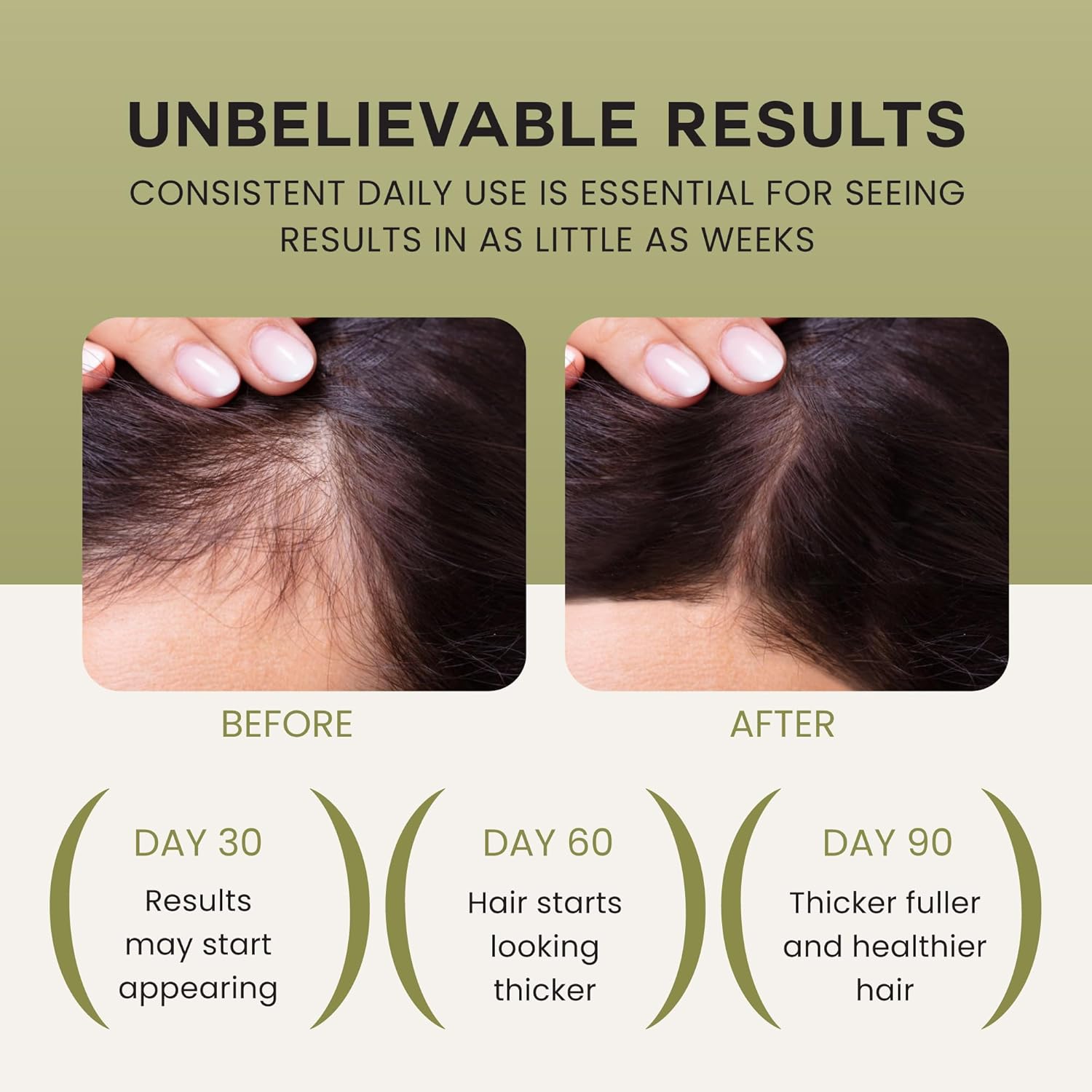 71or2kv4nll. ac sl1500